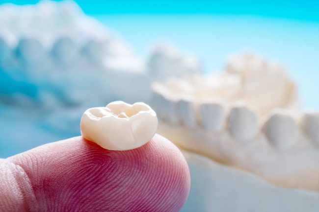 dental-crowns-cgs-dentistry