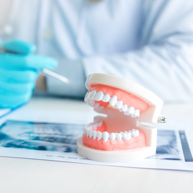 dentures in Coquitlam