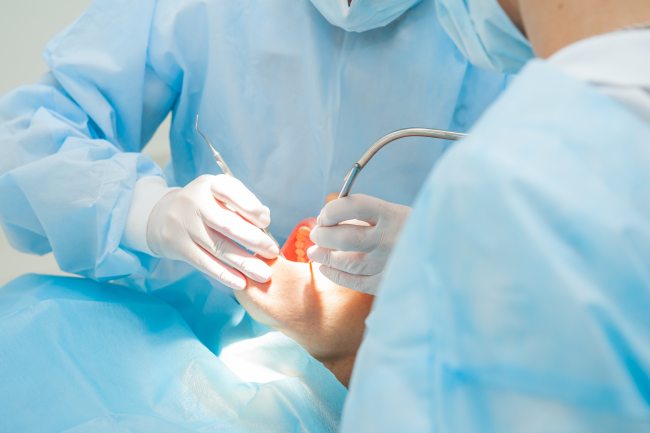 oral-surgery-at-cgs-dentistry