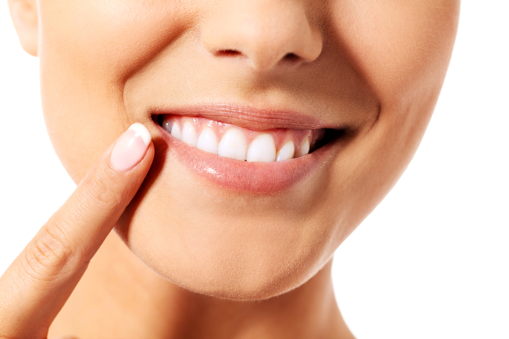 smile correction